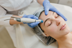 Microdermabrasion bei einer Kundin